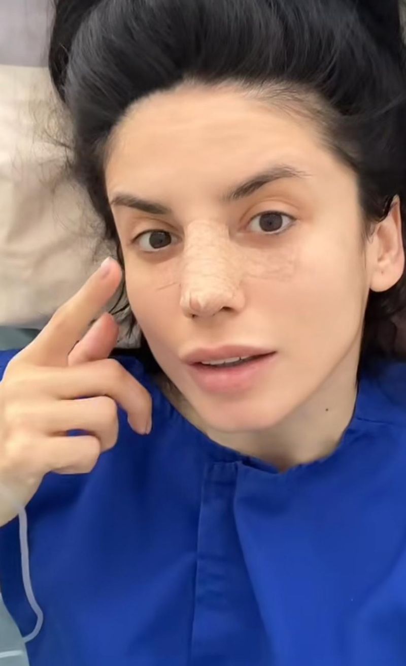 ioana grama, influenceriță, operație, spital, rinoplastie