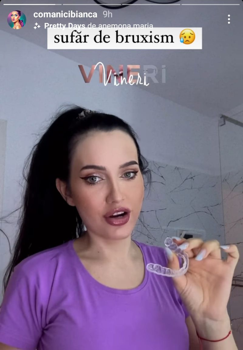 Bianca Comănici suferă de bruxism