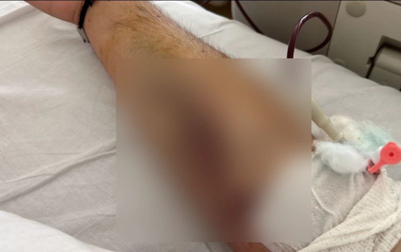 Vasile a fost diagnoticat cu o boală gravă