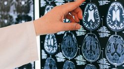 O femeie a avut parte de șocul vieții, după ce a ajuns la spital cu o mulțime de simptome! Medicii i-au scos un vierme de opt centimetri din cutia craniană