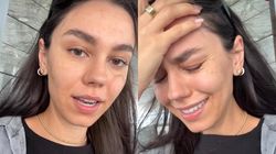 Ghinioane în lanț pentru Mira! Artista nu a scăpat de probleme nici în vacanța din Dubai: „Uitați ce mi-a făcut soarele. M-a umplut de bube”