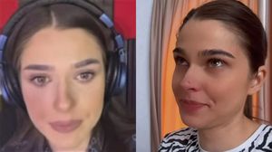 Theo Rose și-a speriat fanii, afișându-se în online cu ochiul umflat și plin de sânge