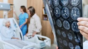 avc, semne accident vasular cerebral, primele simptome accident vascular cerebral, cum îți dai seama că o persaonă are avc