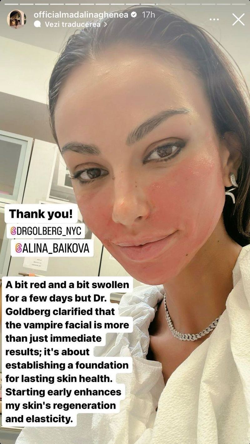 Mădălina Ghenea procedură estetică