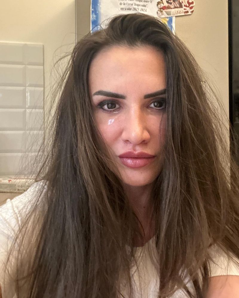 mara banica operatie estetica