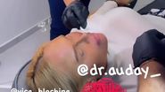 Vica Blochina intervenție estetică