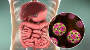 Simptomele Norovirus