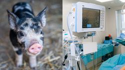 Moartea șocantă a unui bărbat de doar 62 de ani! S-a stins din viață la două luni după ce i-a fost transplantat rinichiul unui porc