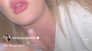 Accident Emily Burghelea