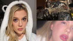 Emily Burghelea, mărturisiri cutremurătoare, la scurt timp după accidentul în care a fost la un pas de a-și pierde viața! Sfatul prețios oferit internauților: „În orice țară ați fi, indiferent de legislație”