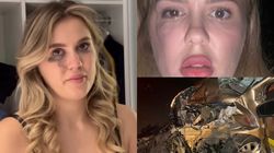 Emily Burghelea, speriată înainte să intre în sala de operații! Ce se întâmplă în aceste momente cu vedeta la spital? Primele declarații: „Sunt gata”