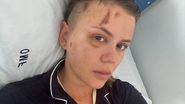 Emily Burghelea în spital