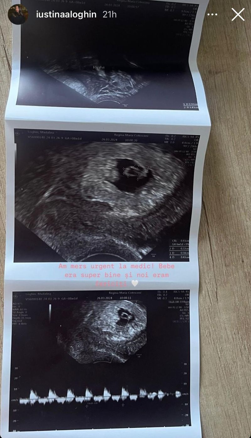 Ecografie iustina, cornel