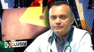 Cât de gravă este, de fapt, rujeola! Medicul Adrian Marinescu trage semnale de alarmă despre simptome și cum putem combate boala: „Complicația poate fi importantă” | EXCLUSIV