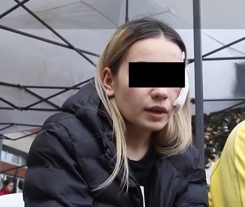 Una dintre supraviețuitoarele incendiului din Macedonia de Nord