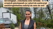 Anca Serea