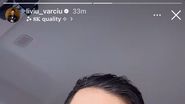 Liviu Vârciu, cu ochiul bandajat
