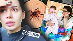 Clipe de coșmar pentru Marisa Paloma, după ce fiica ei a luat o căpușă! Medicul Tudor Ciuhodaru explică tot ce trebuie să știe românii despre căpușe și spune de ce trebuie să ne prezentăm de urgență la spital pentru îndepărtarea acestora | EXCLUSIV