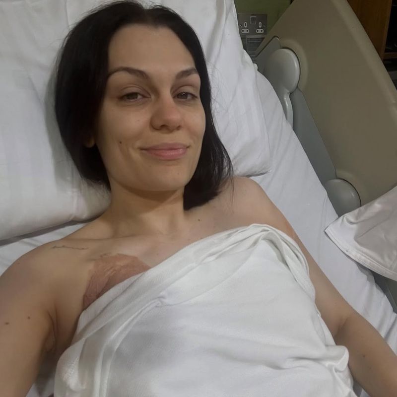 Jessie J