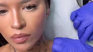 Diandra își scoate tatuajele