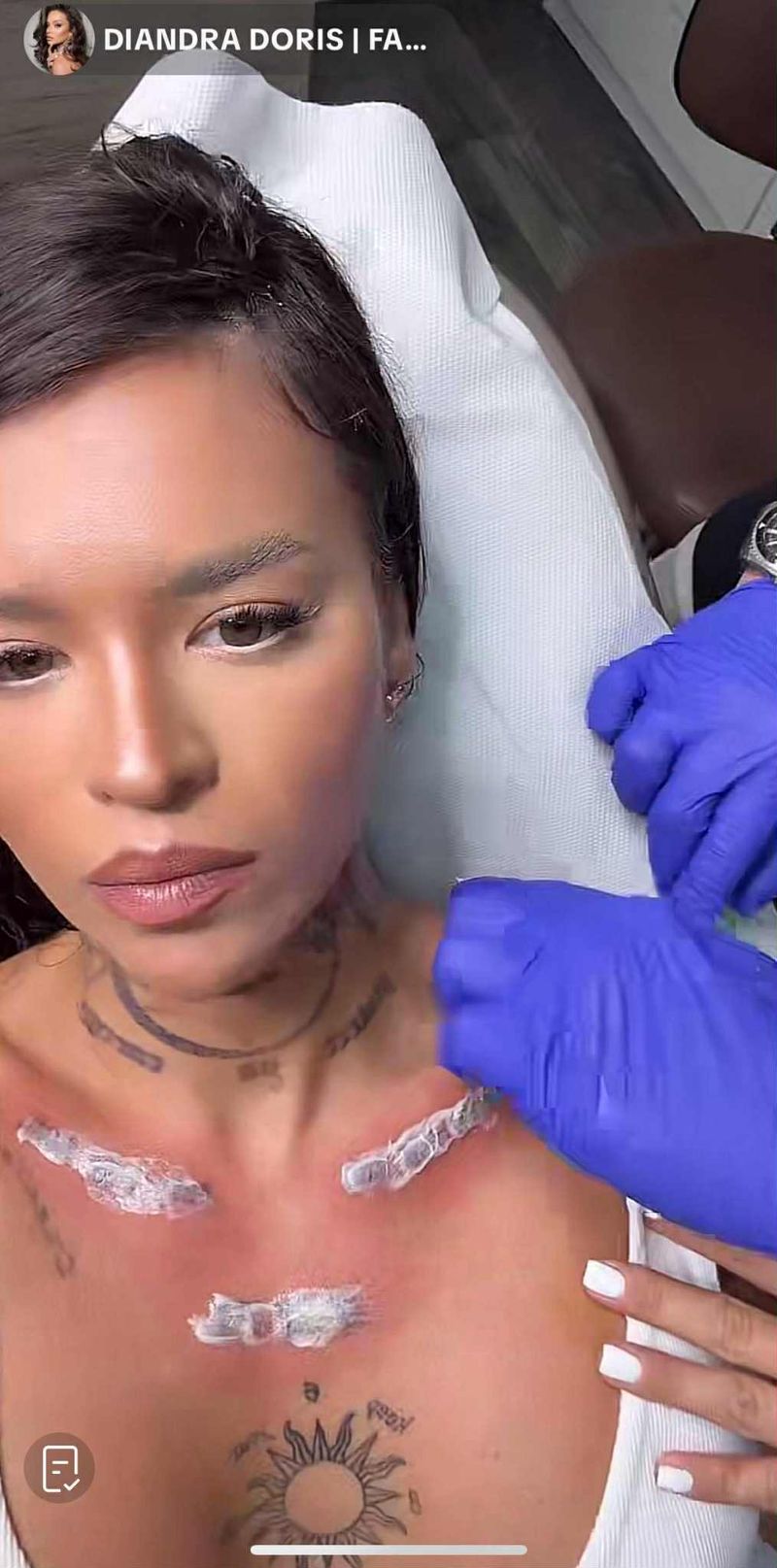 Diandra își scoate tatuajele