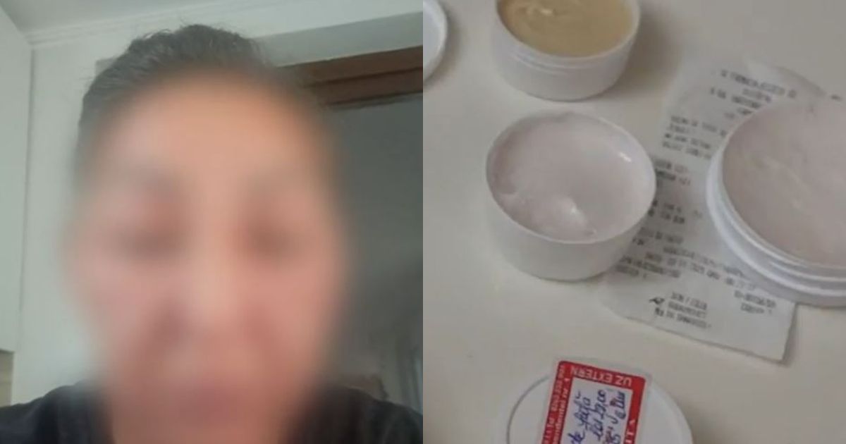 O femeie a ajuns în stare gravă la spital, după ce a folosit o cremă de față: “M-am trezit desfigurată”. Ce conținea produsul. A fost retras de urgență de pe piață