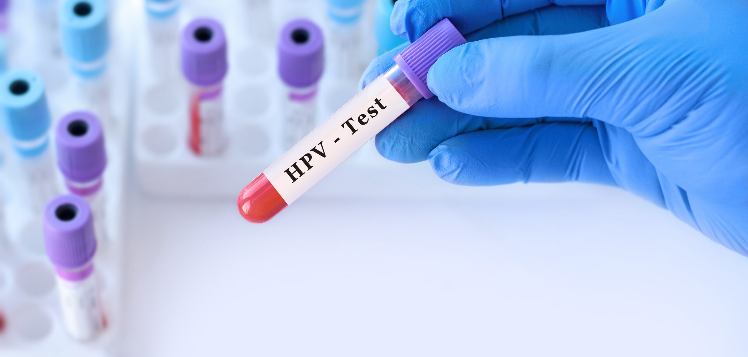 Testare HPV gratuită în București și Craiova, în luna octombrie 2026! Vezi centrele participante și cum îți poți face programare