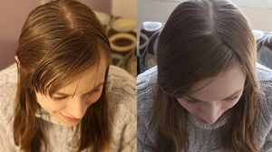 Foto stanga: Asa arata in primele 20 de zile fara sa se spele. Foto dreapta: asa arata dupa ce s-a spalat cu bicarbonat si otet de mere