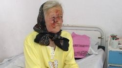 O batrana a fost DESFIGURATA de porcul din gospodarie! Vezi ce a cauzat comportamentul violent al animalului