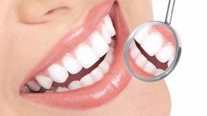 Nu te costa nimic! Cum scapi de tartrul dentar acasa novalue