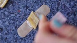 Cum sa scapi de negi cu coaja de banana! Acest remediu e genial!