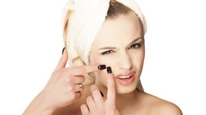 Acneea iti da batai de cap? Iata cum poti combate aceasta problema! novalue