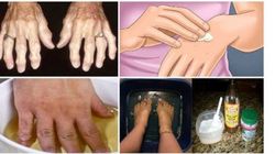 Scapa pentru totdeauna de artrita cu un remediu pe care il poti prepara de azi! Durerile vor disparea, ca prin minune