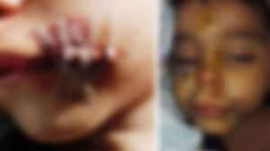 Mutilat de un caine! Un copil din Constanta a ajuns desfigurat dupa ce a fost atacat