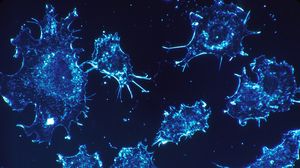 Remediul care ucide peste 90% din celulele canceroase in doar doua zile! Medicii nu vor sa afli asa ceva!