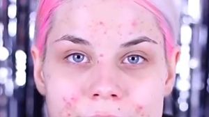 Dovada ca machiajul chiar face minuni! E plina de bube si semne pe fata, dar se transforma radical dupa o sedinta de make-up!