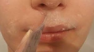 Reteta asta din trei ingrediente te scapa de parul de pe fata pentru totdeauna