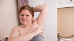 Blestemul unei boli rare – Femeia care miroase mereu a peşte