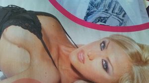 In urma cu cinci ani, cand era supranumita "blonda lui Bote", vedeta avea multe alunite pe piept si o cicatrice urata in zona mamelonului