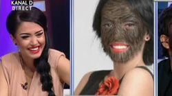 Comparatie super tare! Uite cum ar arata Duban, Madalin Ionescu, Andreea Mantea sau Jean de la Craiova daca ar avea par pe fata precum "omul lup"!