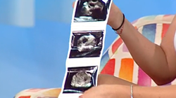 O alta graviduta in showbiz? O blonda celebra a aratat ecografia in direct: "E posibil sa am gemeni!"