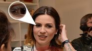 Artista s-a nascut cu o afectiune numita “Nevus Ota”, sau “Pata mongoloida"