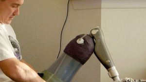 Silviu Prigoana poarta o proteza asemanatoare cu cea din fotografie