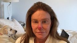 Asa arata acum Caitlyn Jenner, tatal vitreg al lui Kim Kardashian. Ce i s-a intamplat la chip