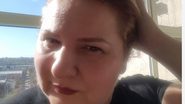 Nicoleta Tociu, la un an de la operatia la san