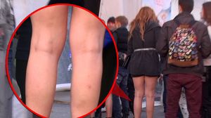 VIDEO EXCLUSIV! Praful s-a ales de idolul adolescentilor din Romania! Vedeta din “Pariu cu viata” nu mai e deloc sexy! Alina Eremia s-a ingrasat si s-a umplut de bube… pe picioare! Picioare grasute si pline de bune - cu asta se mandreste acum Alina Eremia