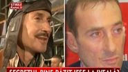Primarul si-ar fi facut si la ochi o interventie estetica
