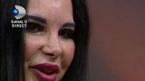 FOTO & VIDEO! SOCANT! Marinela Nitu are fata praf de la atatea interventii estetice! De rusine, in ultimul clip, bruneta si-a ascuns chipul! Specialistii i-au analizat trasaturile deformate! Din pacate, vestile nu sunt deloc bune pentru ea novalue