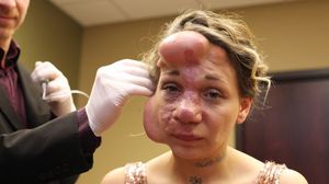 Duce o viata normala, desi sufera de o afectiune groaznica! O sa te inchini cand vezi cum arata chipul acesti femei! novalue