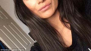 Dumnezeule, brunetica asta a fost desfigurata din cauza unui tratament de albire a dintilor! Uite cum arata acum! Mai ca nu-ti dai seama ca in imagini e aceeasi persoana